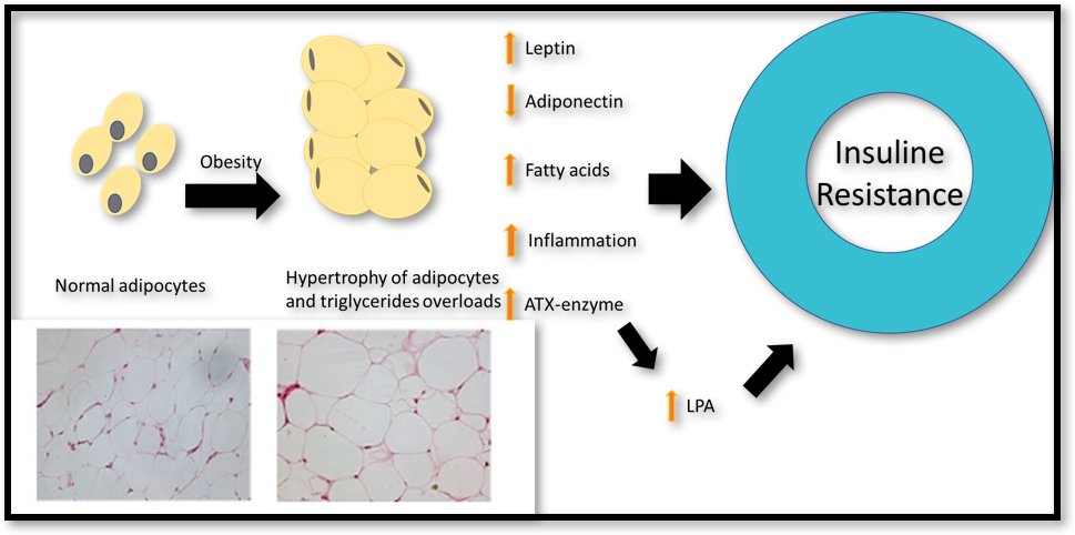The Link Between Diabetes Mellitus and Obesity