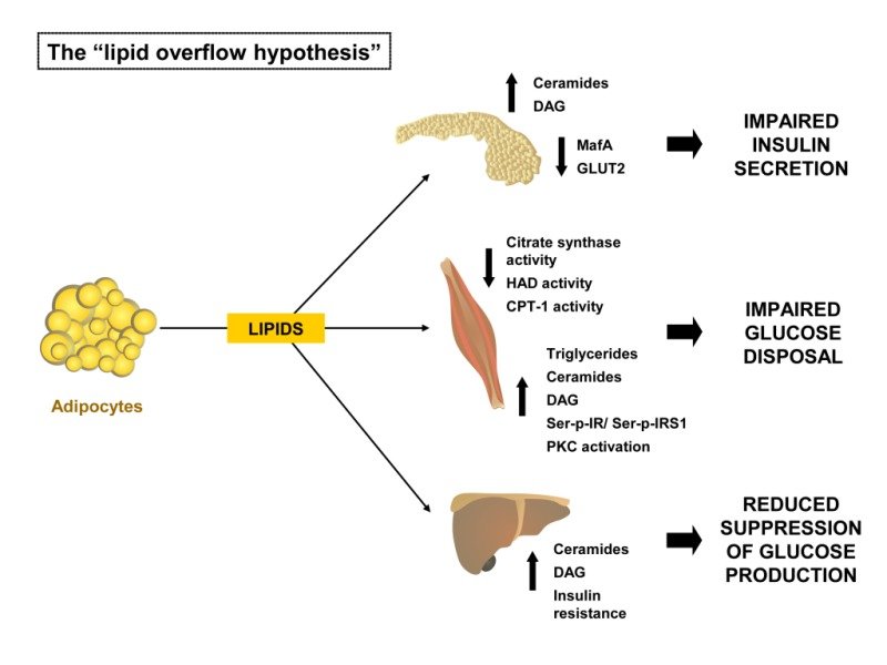The Link Between Diabetes Mellitus and Obesity