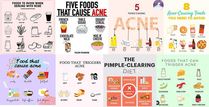 The Link Between Diet and Acne