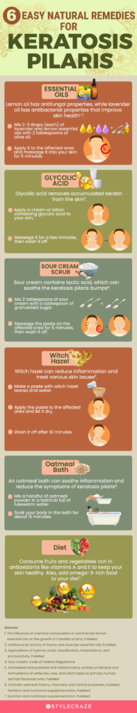 The Link Between Diet and Keratosis Pilaris: What to Eat and Avoid