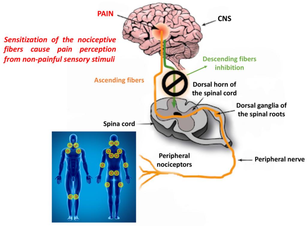 The Link Between Fibromyalgia and Mental Health: Exploring the Connection