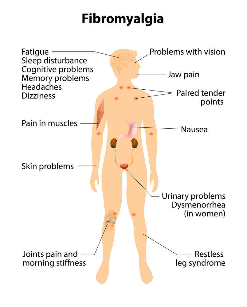 The Link Between Fibromyalgia and Mental Health: Exploring the Connection