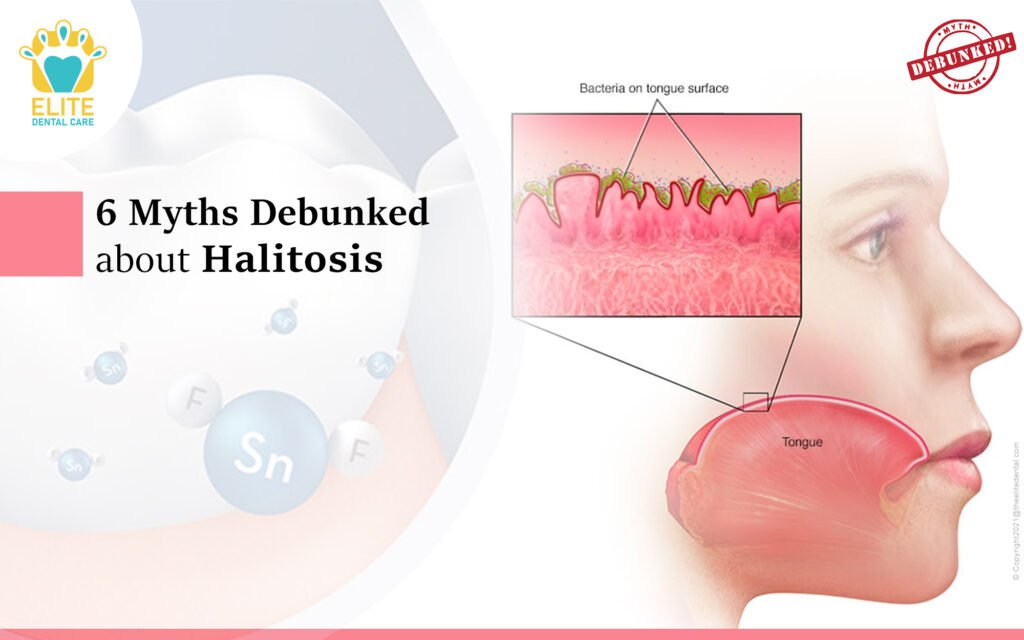 The Link between Halitosis and Dental Health