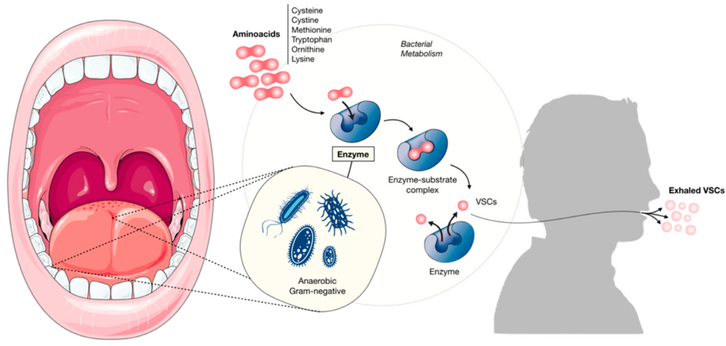 The Link between Halitosis and Dental Health