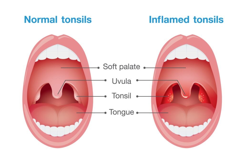 The Link between Halitosis and Dental Health