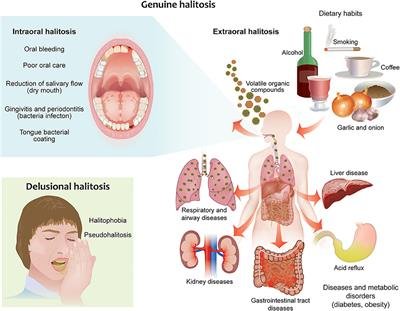 The Link between Halitosis and Dental Health