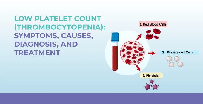 The Link Between Low Blood Platelets and Certain Medical Conditions
