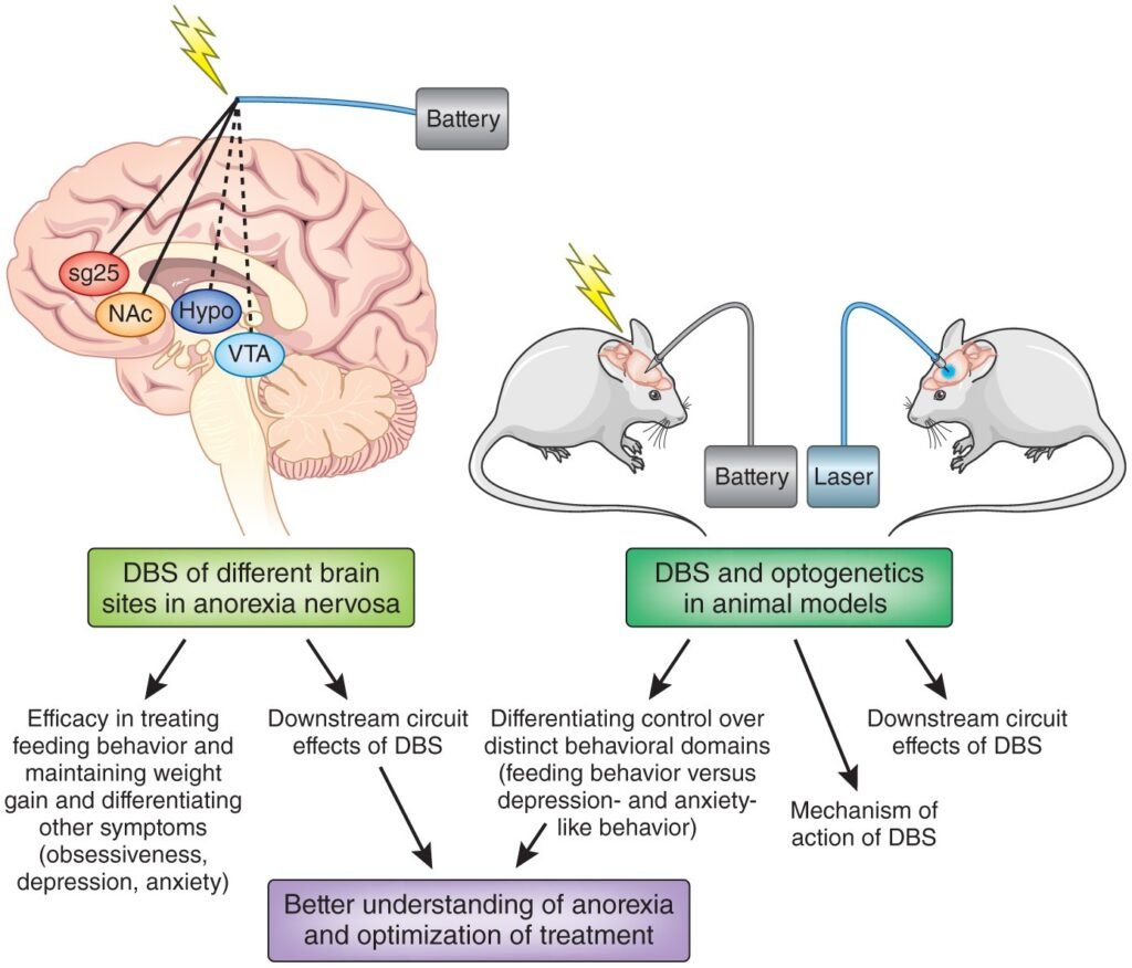 The Psychological Effects of Anorexia: A Deep Dive into the Mind