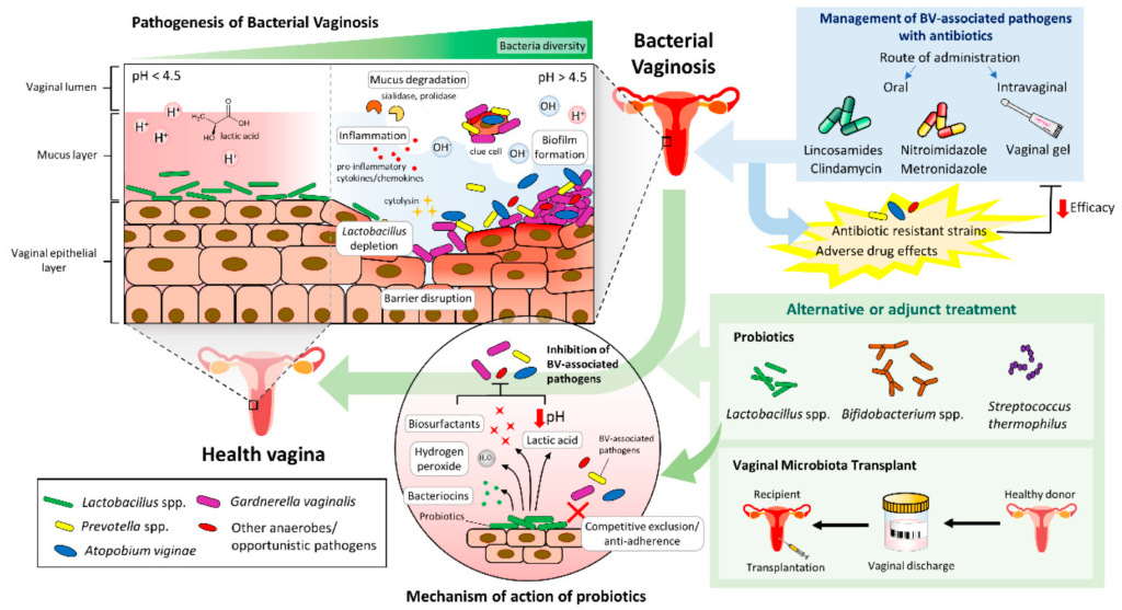 The Role of Antibiotics in Treating Bacterial Vaginosis