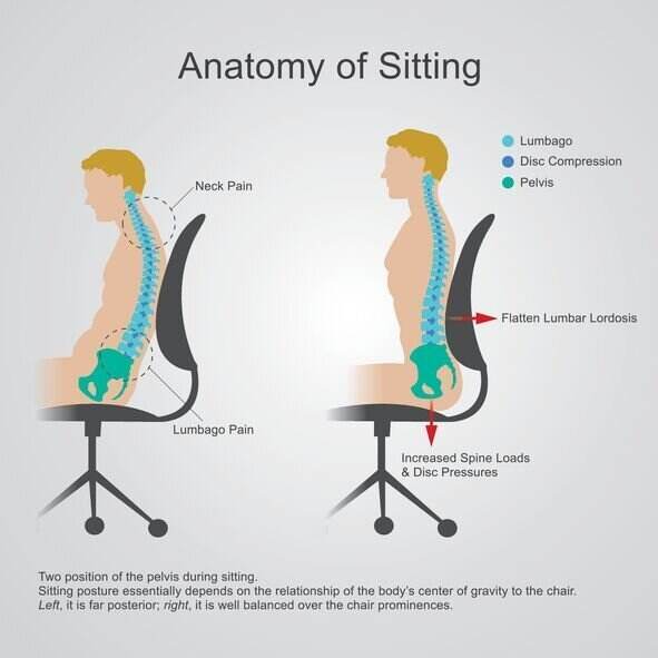The Role of Posture in Lower Back Pain
