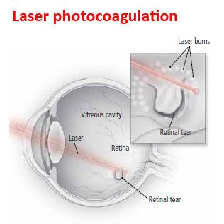 The Science Behind Eye Flashes: Causes and Prevention