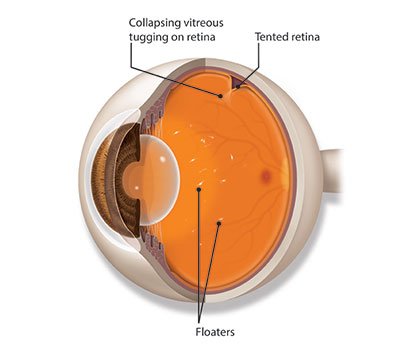 The Science Behind Eye Flashes: Causes and Prevention