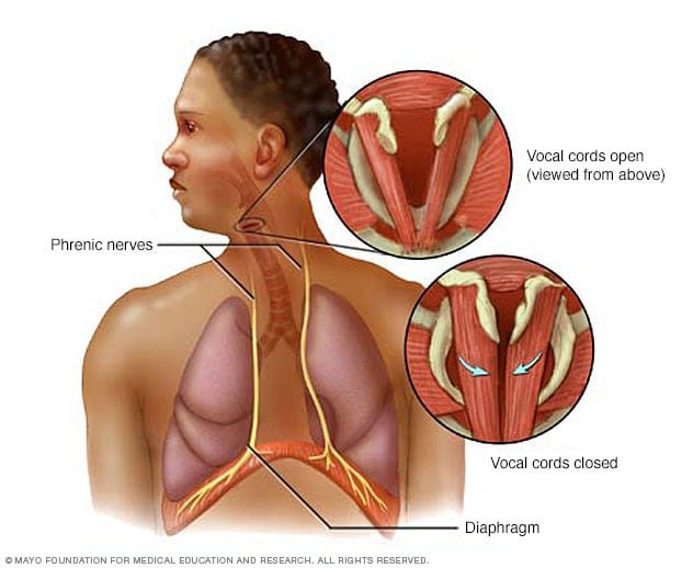 The Science Behind Hiccups and How to Stop Them