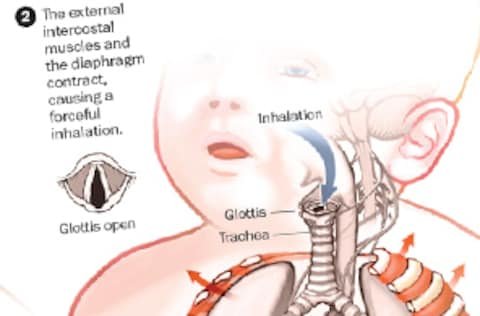 The Science Behind Hiccups and How to Stop Them