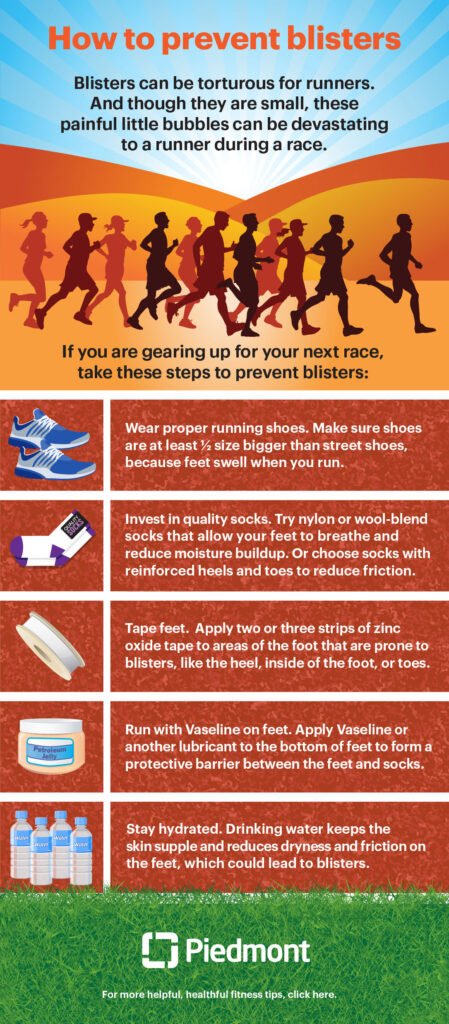 Tips for Preventing Blisters During Exercise