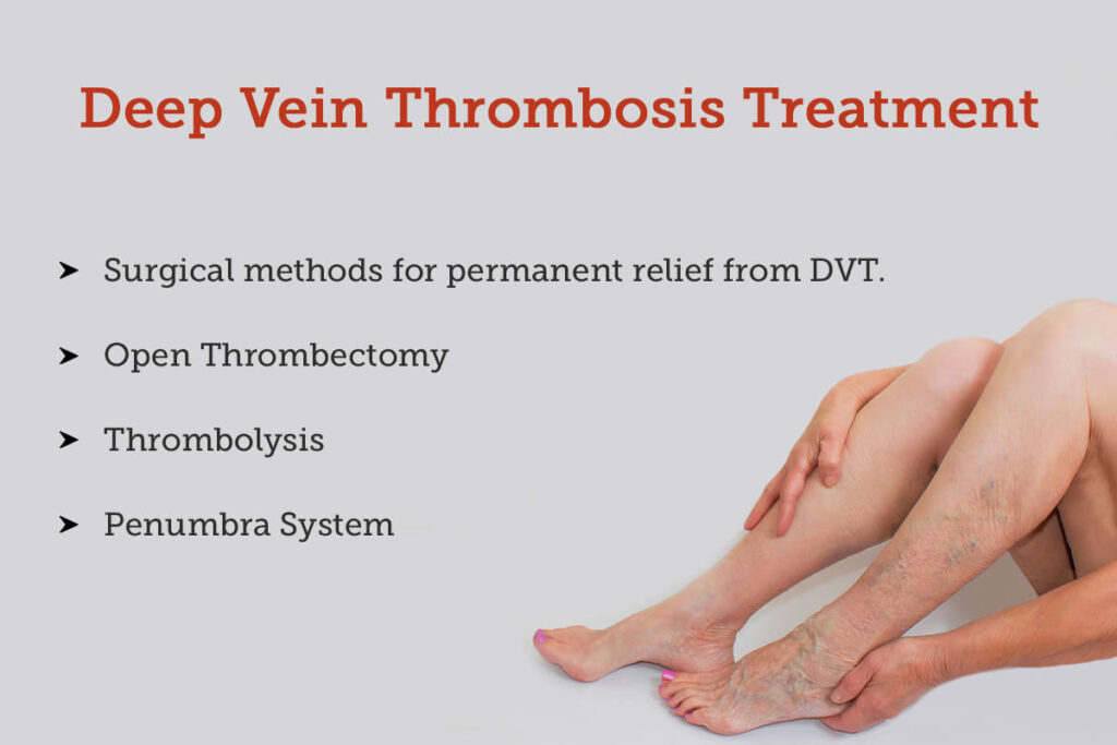 Treating Deep Vein Thrombosis Treating Deep Vein Thrombosis