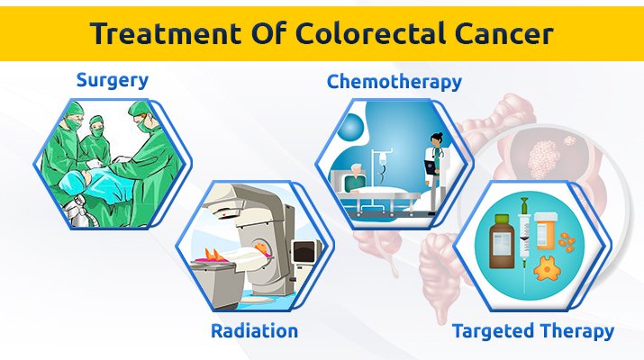 Treatment Options for Colorectal Cancer