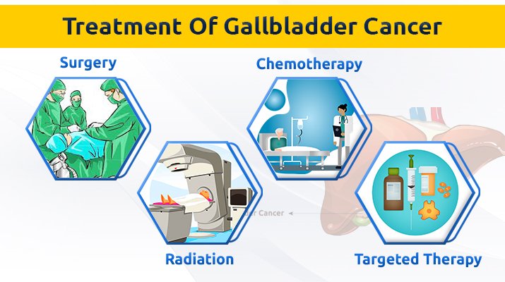 Treatment Options for Gallbladder Cancer Treatment Options for Gallbladder Cancer