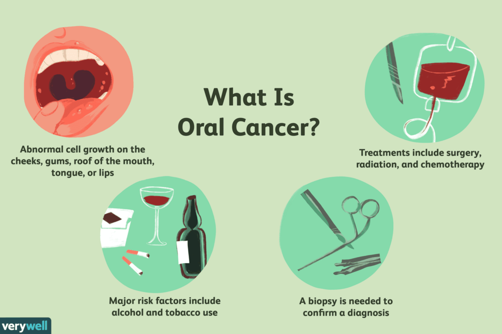 Treatment Options for Mouth Cancer