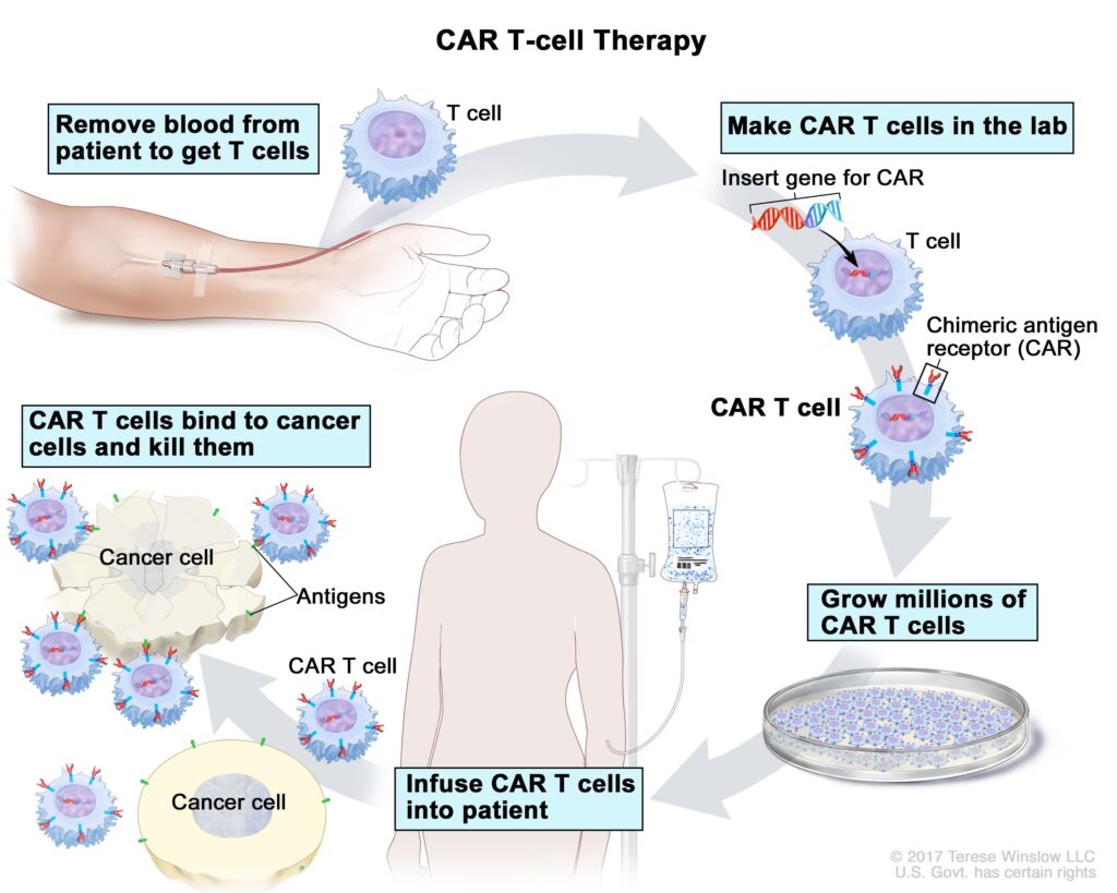 Understanding Acute Lymphoblastic Leukemia in Children