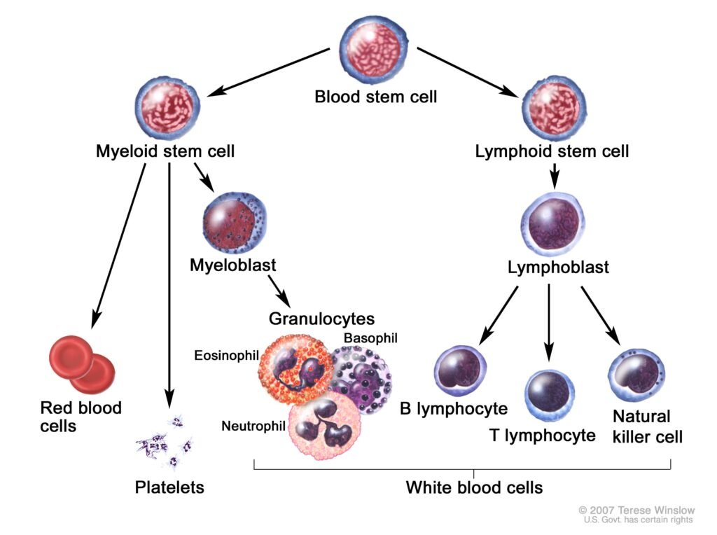 Understanding Acute Myeloid Leukemia in Children