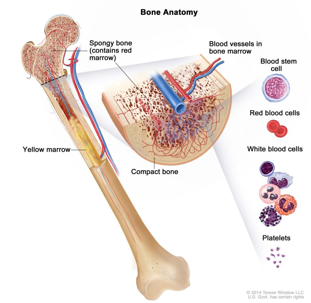 Understanding Acute Myeloid Leukemia in Children