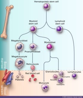 Understanding Acute Myeloid Leukemia in Children