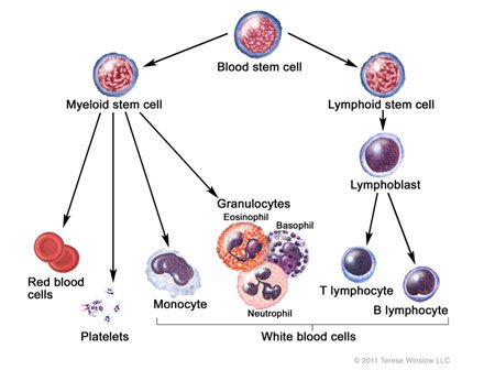 Understanding Acute Myeloid Leukemia in Children