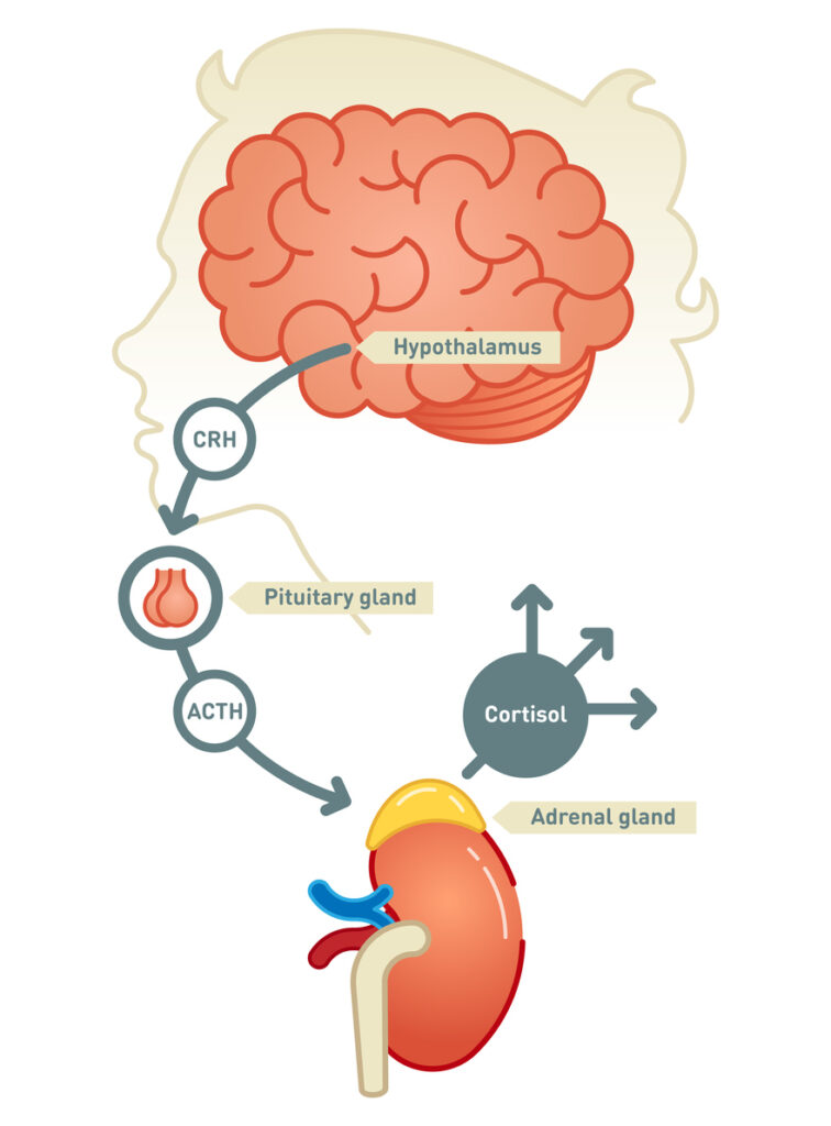 Understanding Addisons Disease Understanding Addisons Disease