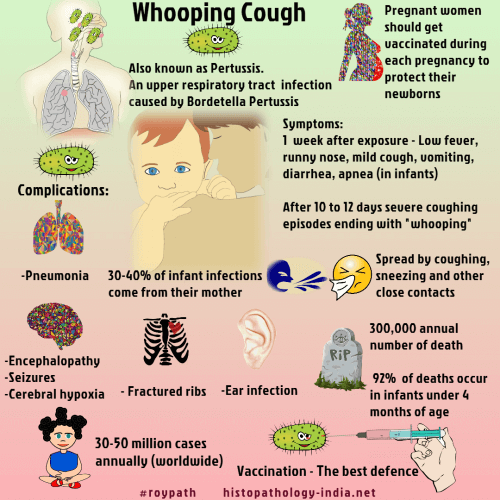 Understanding Bordetella Pertussis: Causes, Symptoms, and Treatment