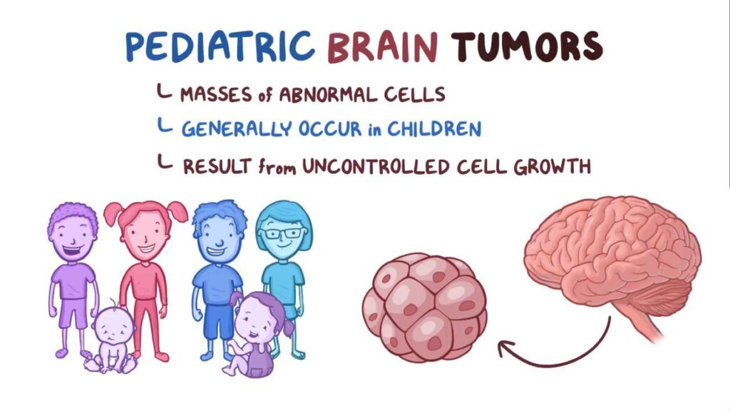 Understanding Brain Tumors in Children
