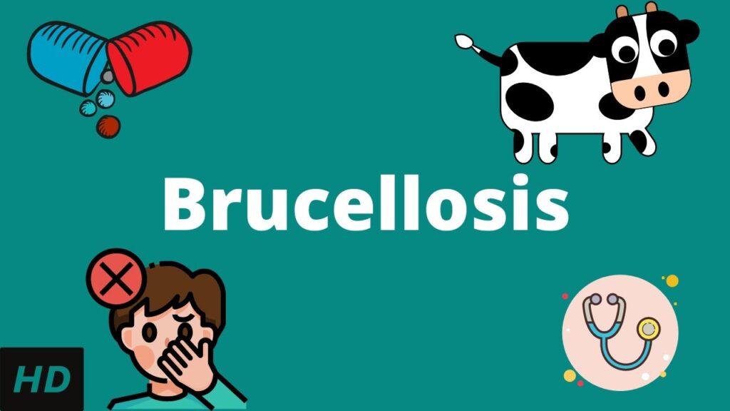 Understanding Brucellosis: Symptoms, Diagnosis, and Treatment