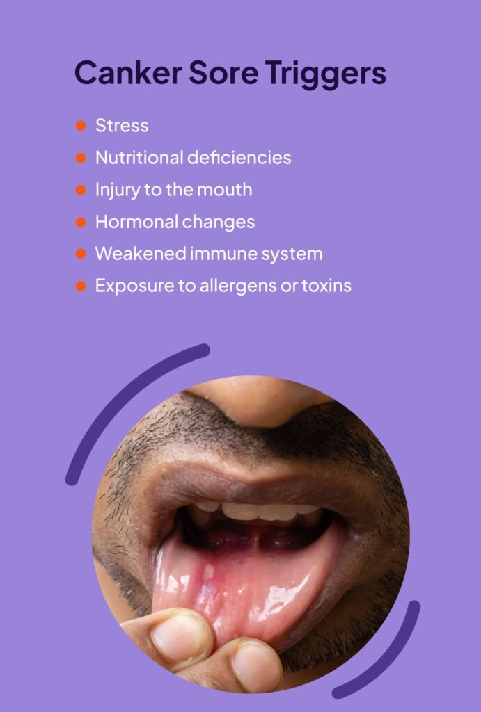 Understanding Canker Sores: Causes and Remedies