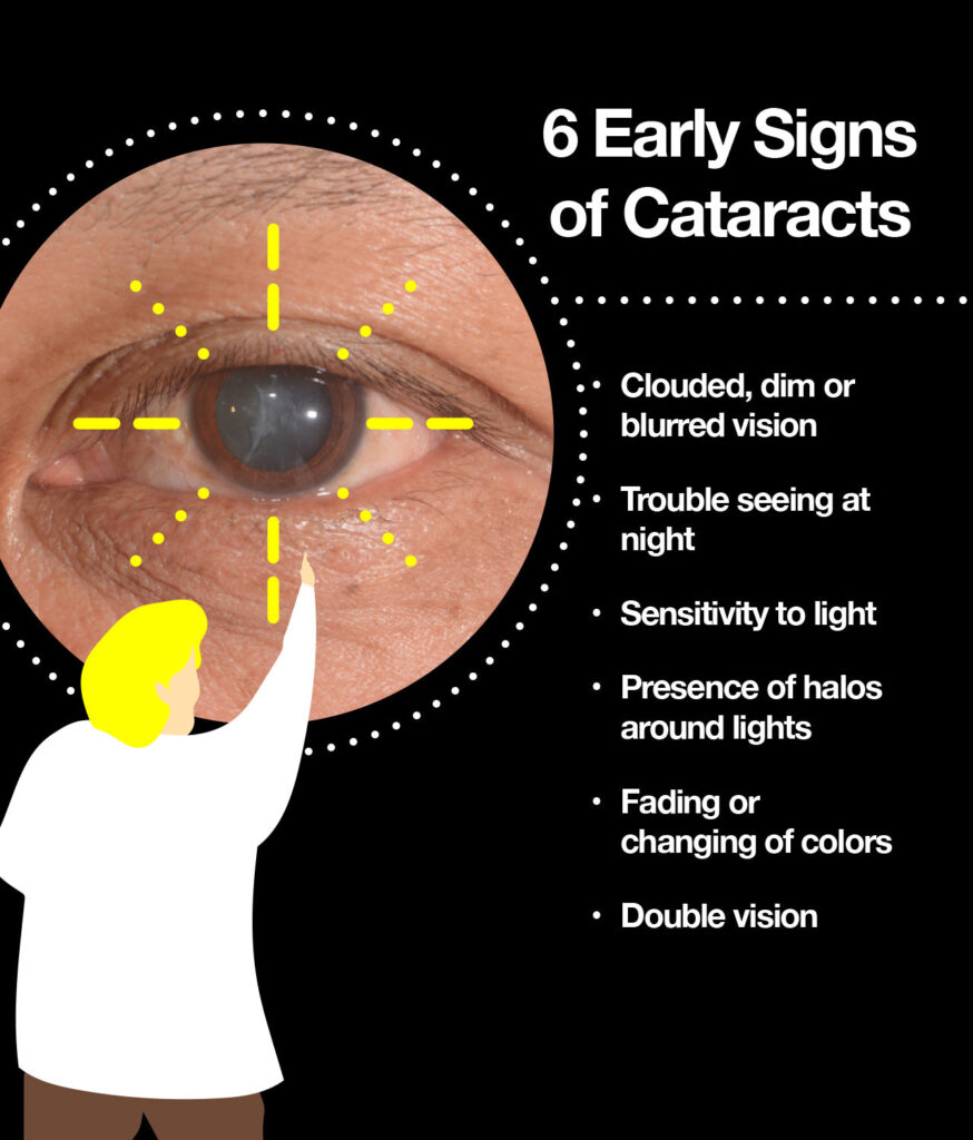 Understanding Cataract: Causes, Symptoms, and Treatment
