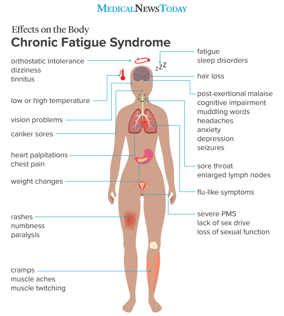 Understanding Chronic Fatigue Syndrome