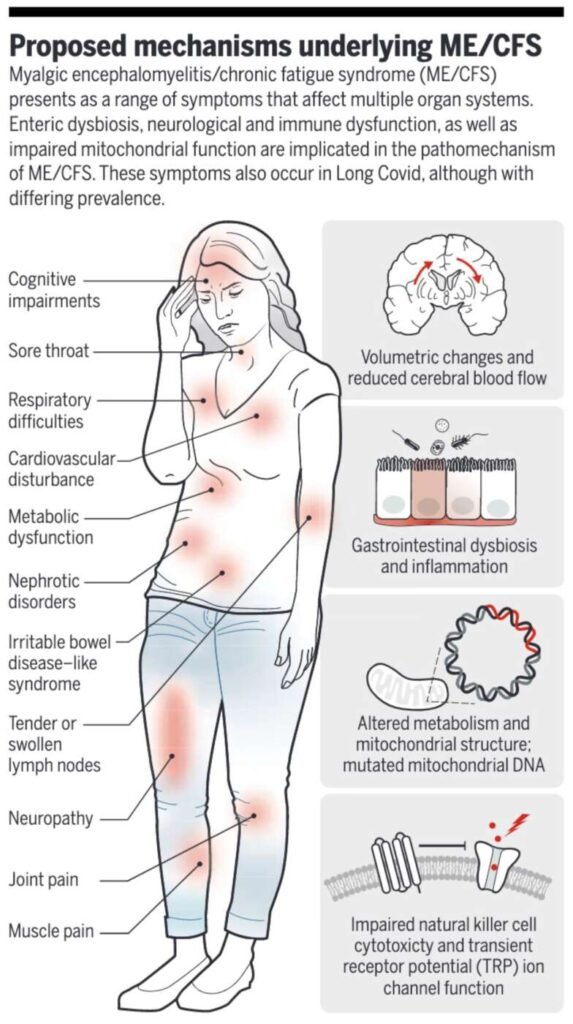 Understanding Chronic Fatigue Syndrome