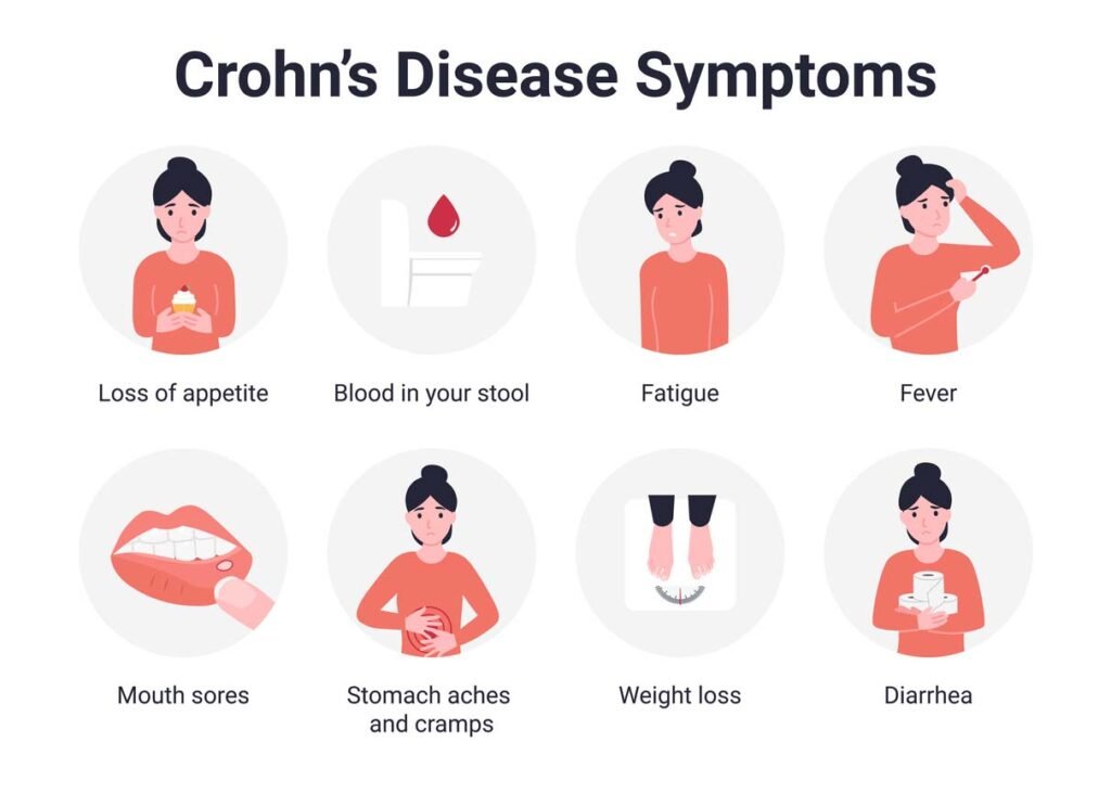 Understanding Crohn’s Disease: Causes, Symptoms, and Treatment