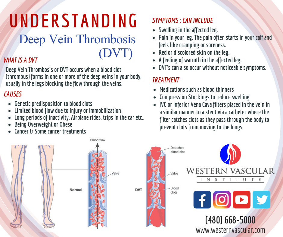 Understanding Deep Vein Thrombosis Understanding Deep Vein Thrombosis