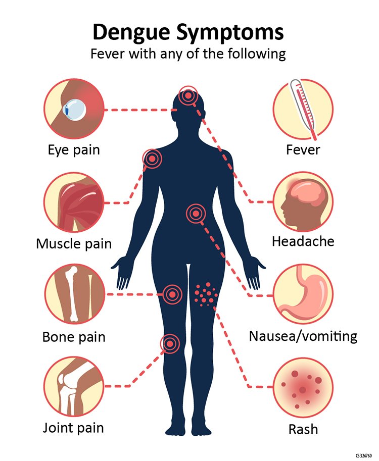 Understanding Dengue: Symptoms, Causes, and Prevention