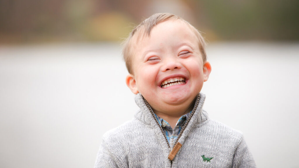 Understanding Downs Syndrome