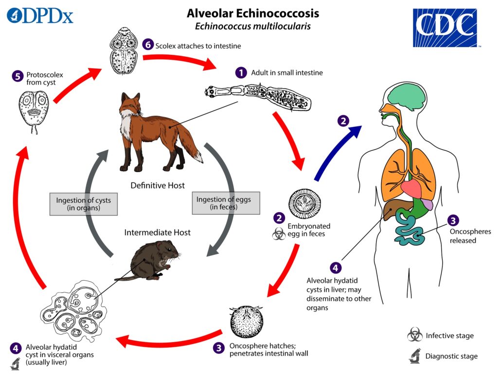 Understanding Echinococcosis: Causes, Symptoms, and Treatment Understanding Echinococcosis: Causes, Symptoms, and Treatment