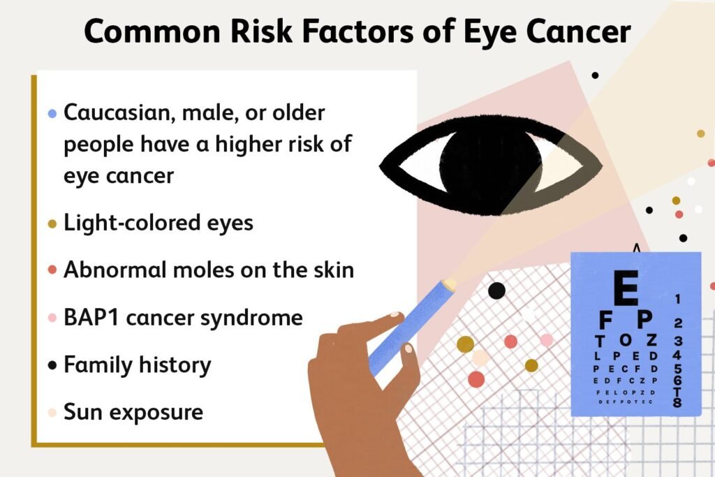 Understanding Eye Cancer: Causes, Symptoms, and Treatments