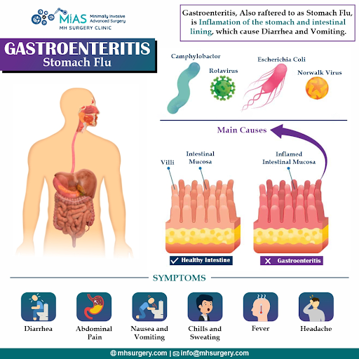 Understanding Gastroenteritis: Causes, Symptoms, and Treatment
