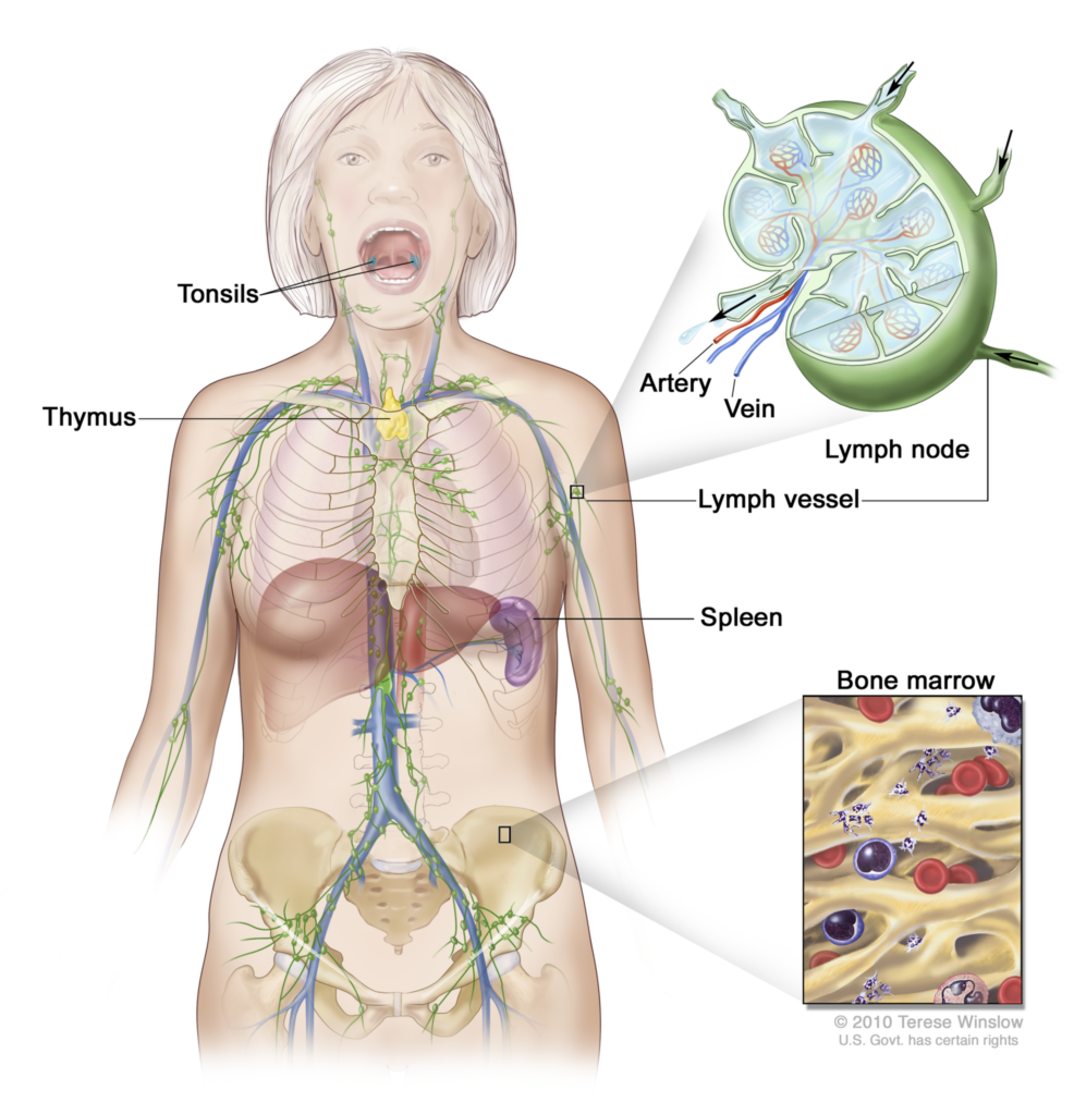 Understanding Hodgkin Lymphoma