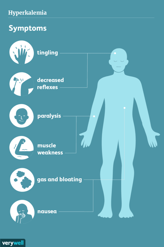 Understanding Hyperkalemia