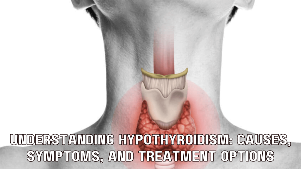 Understanding Hypothyroidism: Causes, Symptoms, and Treatment Options