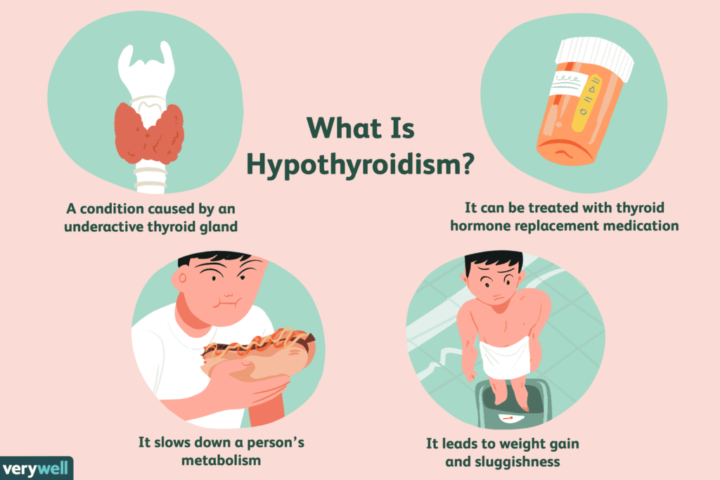 Understanding Hypothyroidism: Causes, Symptoms, and Treatment Options