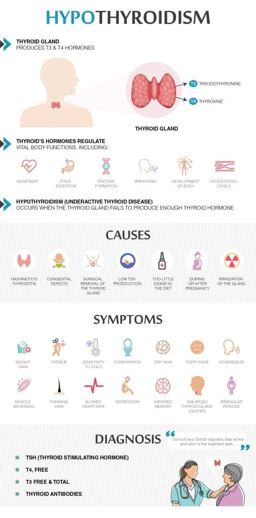 HYPOTHYROIDISM CAUSE AND TREATMENT visual data 4