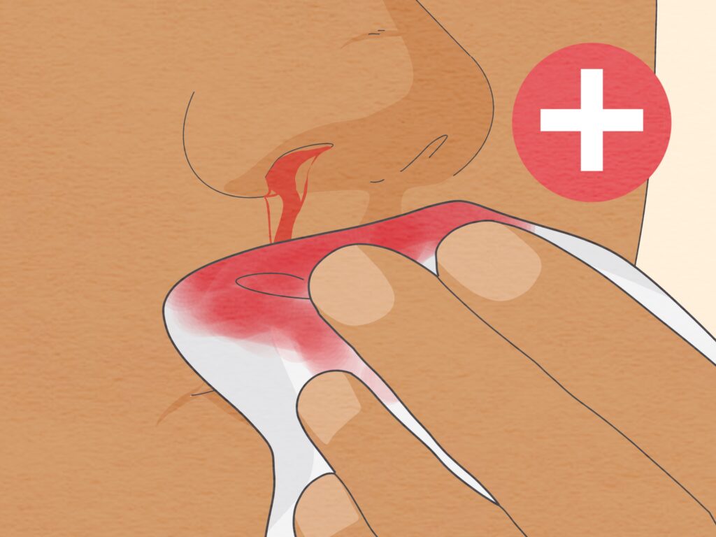 Understanding Internal Bleeding