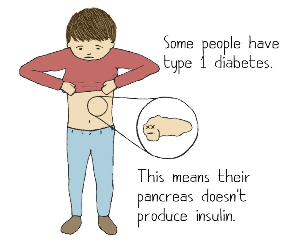 Understanding Juvenile Diabetes